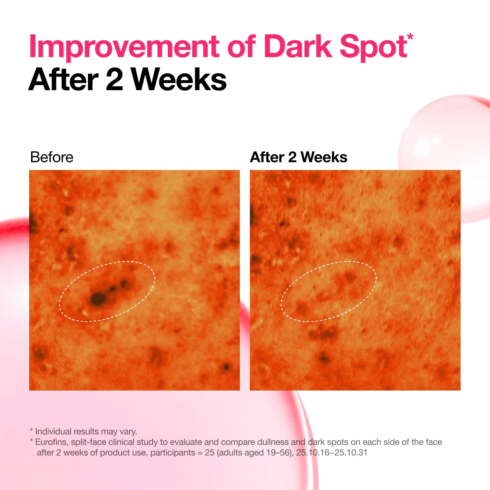 Clinical Comparison Dark Spot Reduction